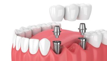 qdental